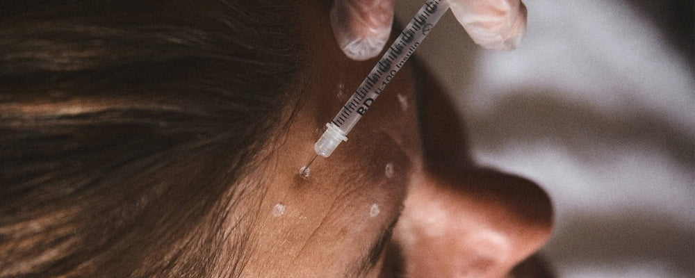 Anti-Wrinkle Injections