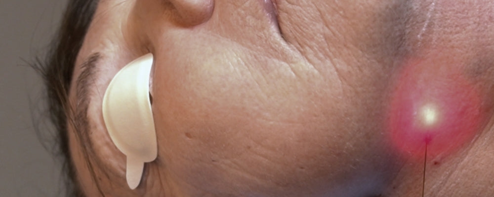 Endolift Skin Tightening Treatment