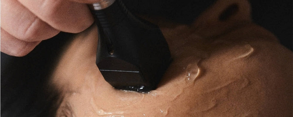 Mesotite Facial