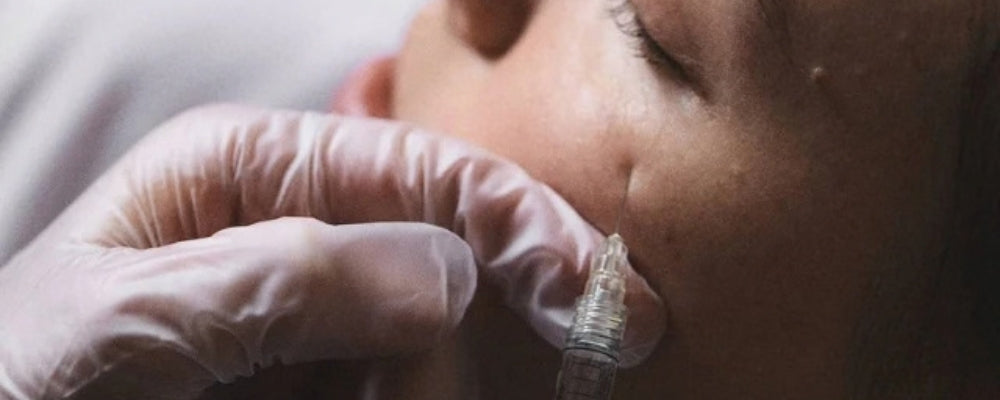 Platelet-Rich-Plasma (PRP) for Face and Neck