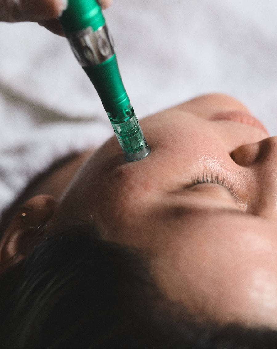 Pigmentation Facial