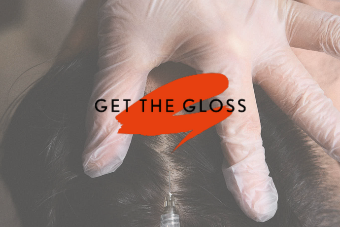 Nucleofill is Among the Best, Doctor Approved Hair Restoration Treatments for Get The Gloss