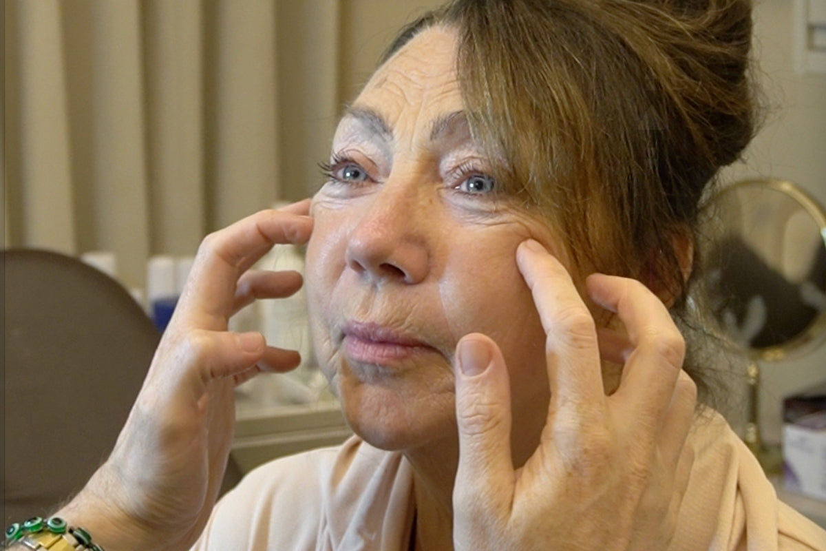 A Layered Approach to Facial Ageing in Your late 50s: Michelle's Full-Face and Neck Before and After