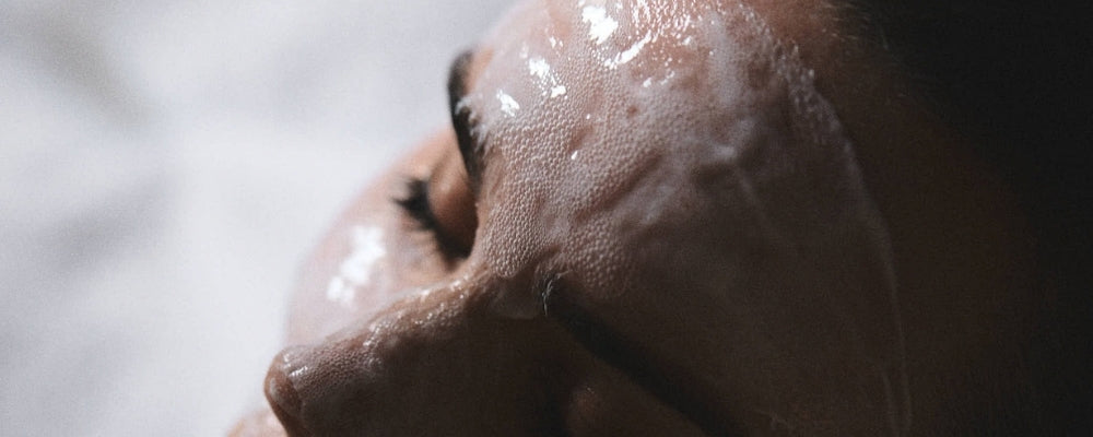 Acne Facial