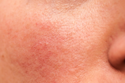 What Retinol Really Does: a Scientific Guide to Strengths, Side Effects and Resuts