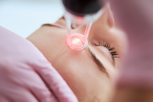 Fractional and Ablative lasers for laser skin tightening