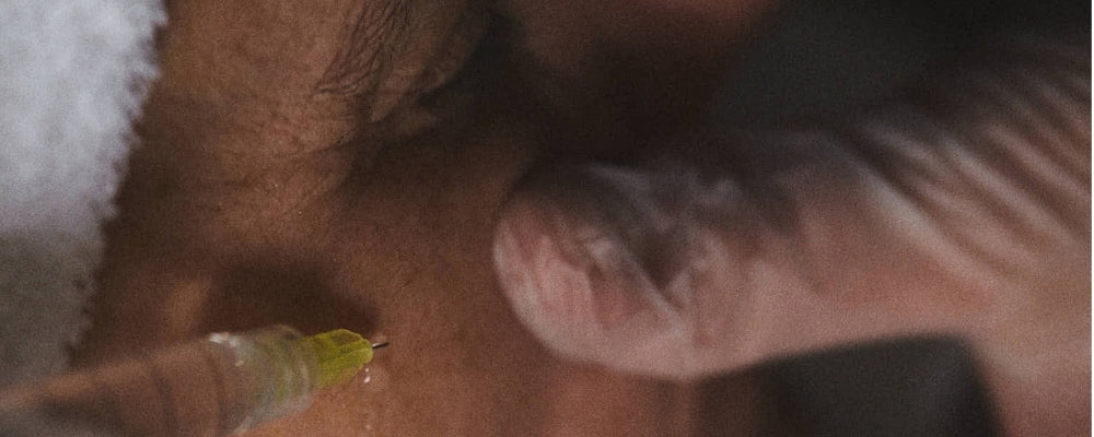 Carboxytherapy