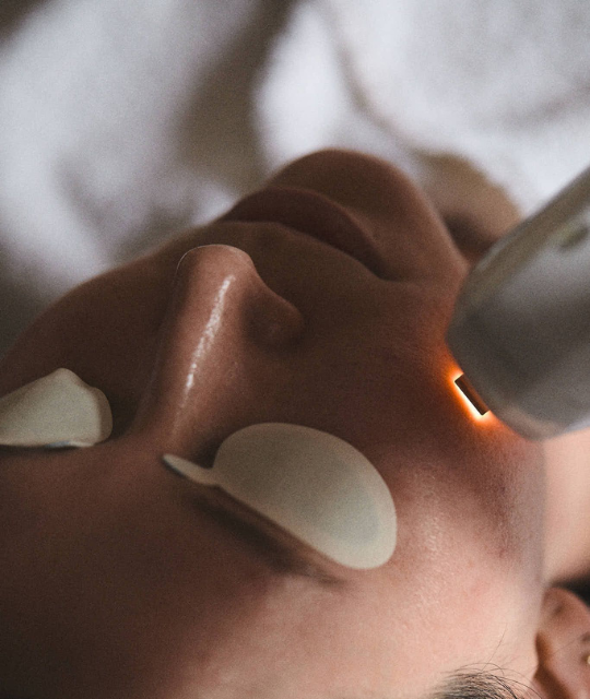 Lumecca™ IPL Therapy