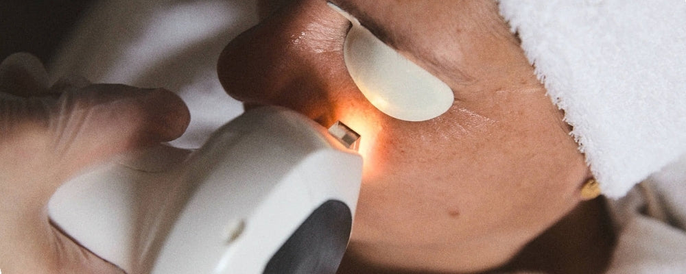 Lumecca™ IPL Therapy