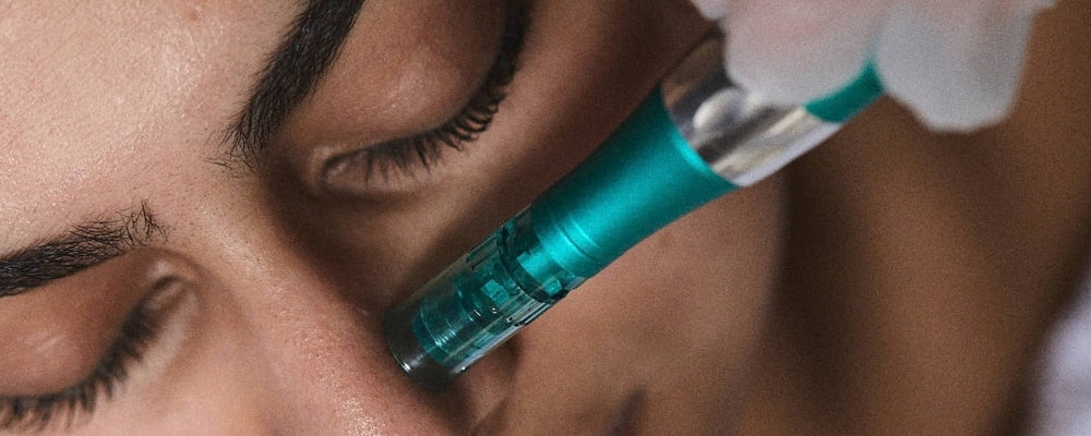 Microneedling