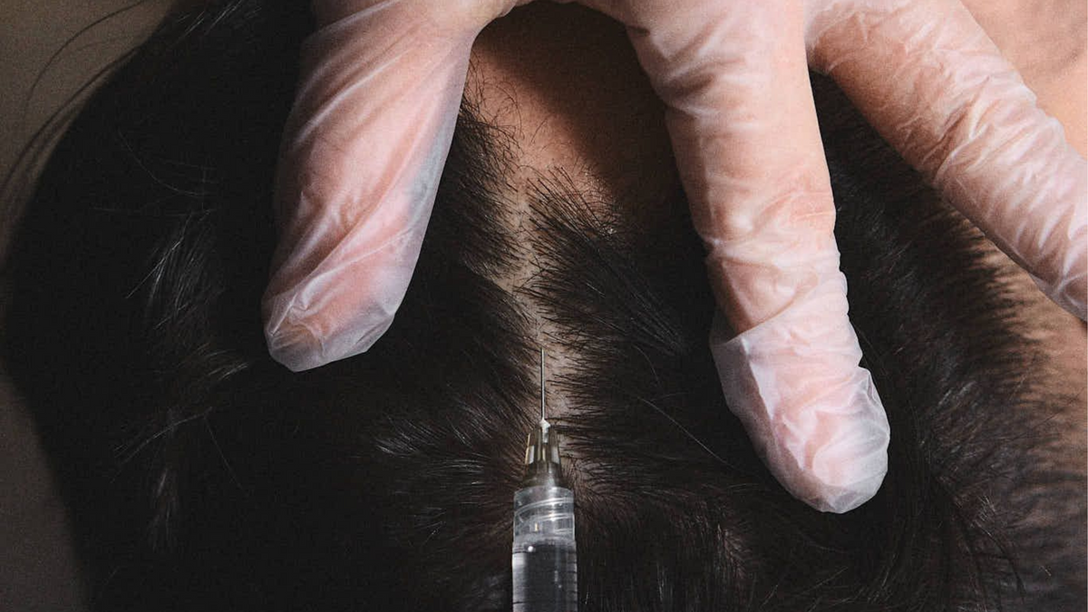 The Non-Surgical Stepladder for Hair Growth