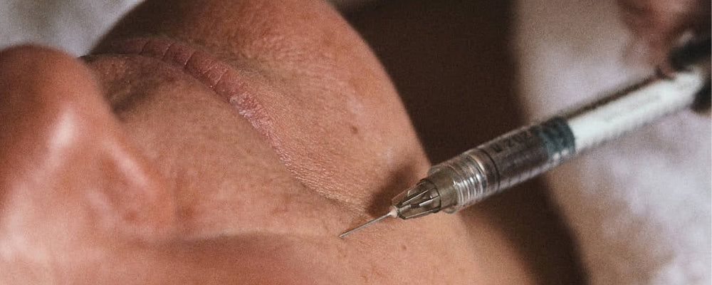 Dermal Filler Removal