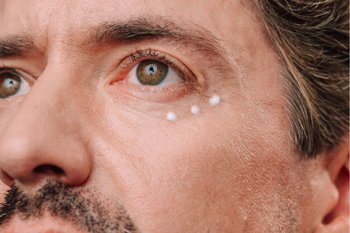 Dark Circles, Eye Wrinkles & Hollow Eyes in Men