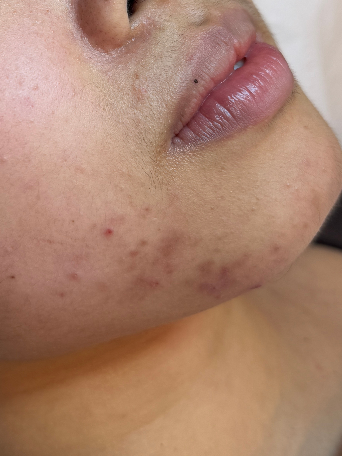 Before