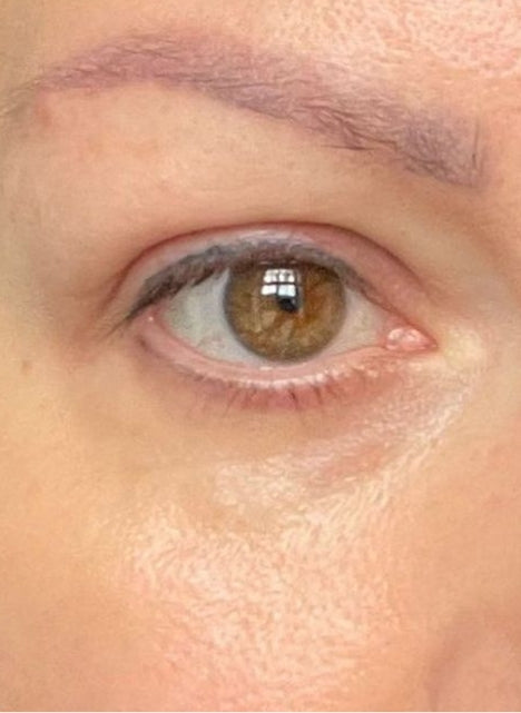 After Bright Eyes