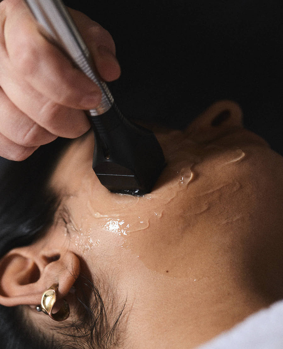 Mesotite Facial
