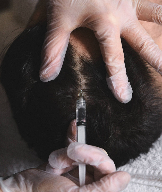 Hair treatments