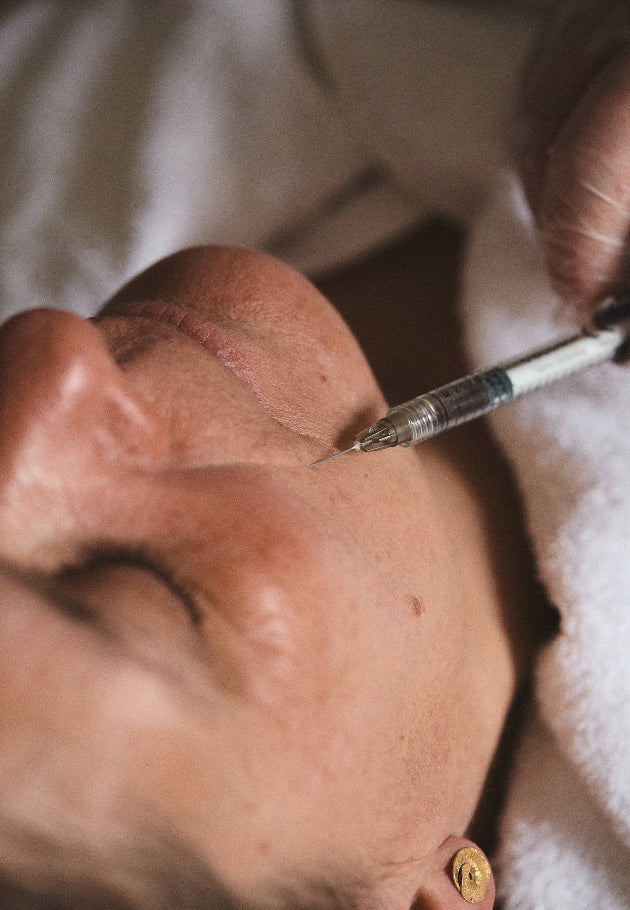 Tear Trough Filler
