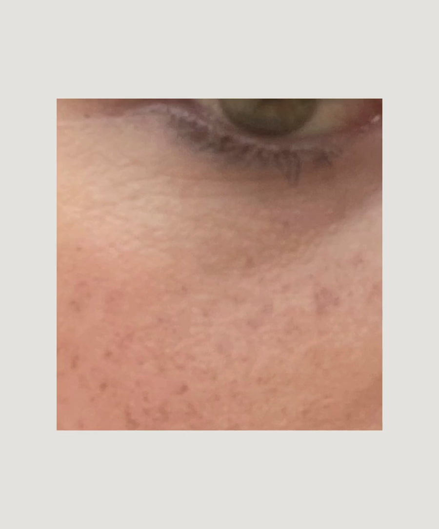 Close-up of skin under the eye